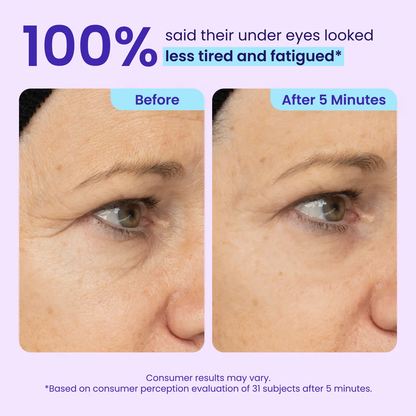 Erase Eye Bags in Minutes — Eye Cream Look Refreshed Instantly ⚡Flash Sale🔥