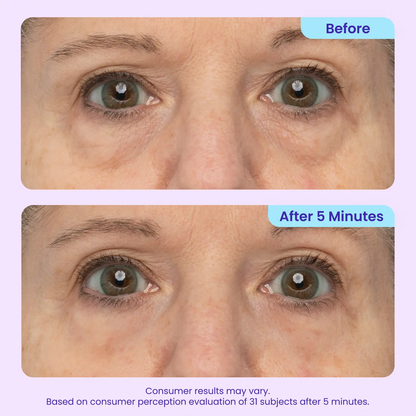 Erase Eye Bags in Minutes — Eye Cream Look Refreshed Instantly ⚡Flash Sale🔥