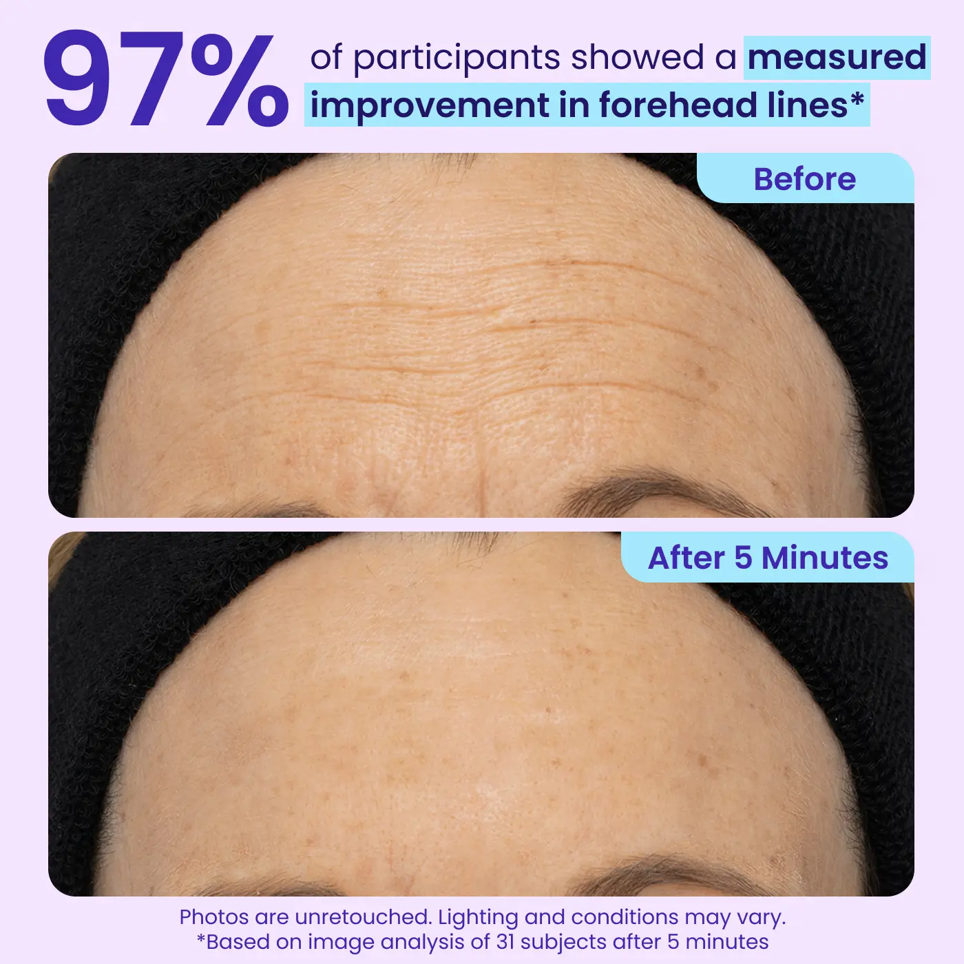 Erase Eye Bags in Minutes — Eye Cream Look Refreshed Instantly ⚡Flash Sale🔥