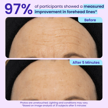 Erase Eye Bags in Minutes — Eye Cream Look Refreshed Instantly ⚡Flash Sale🔥